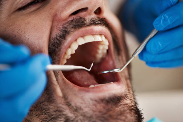 Emergency Cosmetic Dentistry